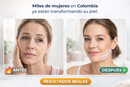 Masajeador Facial Reductor De Papada ECO